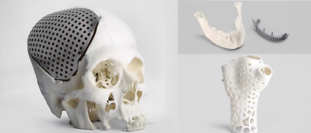The Impact of 3D Printing on the Medical Device Industry