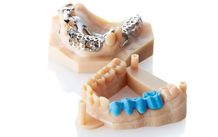 3D printed dental models and restorations
