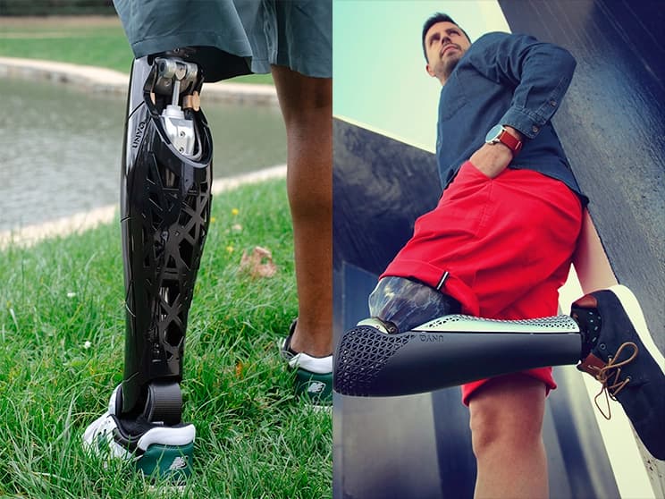 Custom 3D printed prosthetic covers with personalized geometry