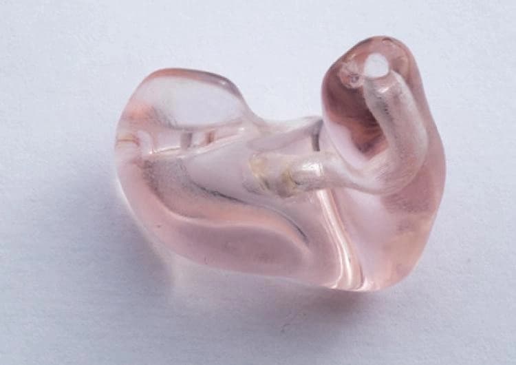 3D printed hearing aid shells in clear resin